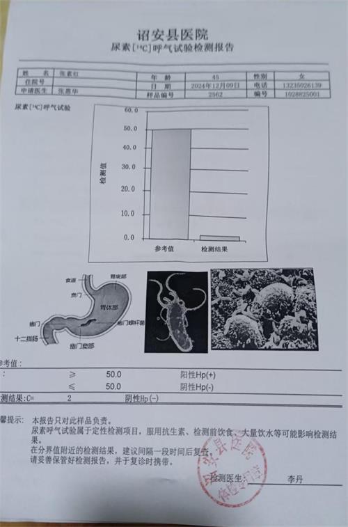 獲得其他